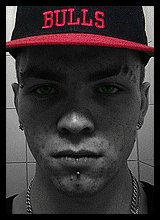 avpic