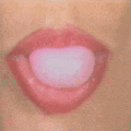 Misy