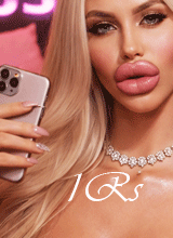 1rS