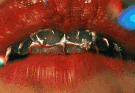 Linology