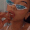 Guest_Laparaa2