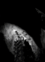 druglung