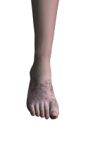 StinkFist